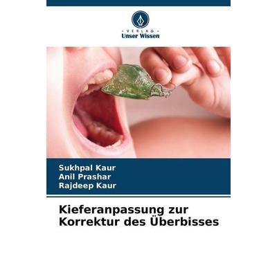 Kieferanpassung zur Korrektur des Überbisses, Taschenbuch von Sukhpal Kaur,Anil Prashar,Rajdeep Kaur, Verlag Unser Wissen, 978-620-8-89916-5