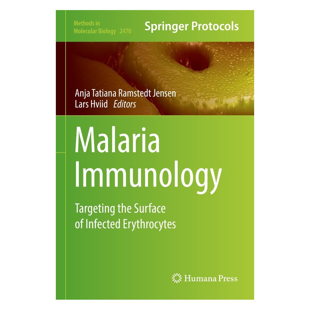 Springer Malaria Immunology (Englisch, Hardcover, Anja Tatiana Ramstedt Jensen, Lars Hviid) (9781071621882)