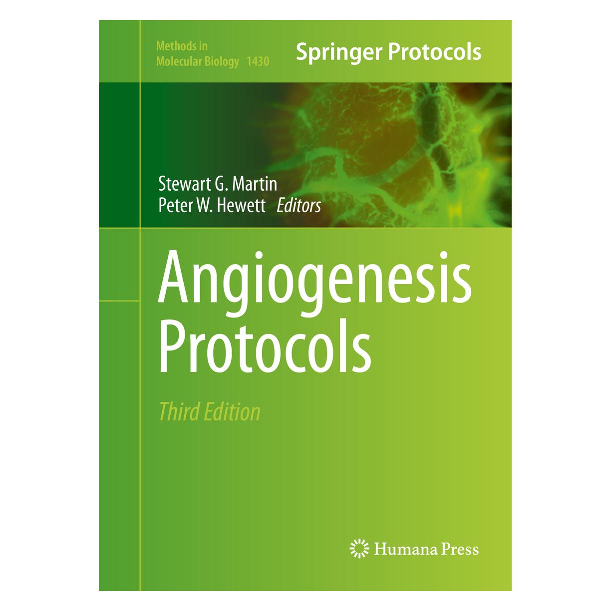Springer Angiogenesis Protocols (Englisch, Hardcover, Peter W. Hewett, Stewart G. Martin) (9781493936267)