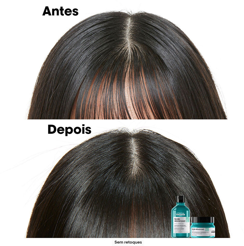 L'Oréal Professionnel Paris Scalp Advanced shampooing 500 ml