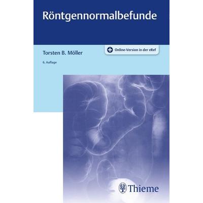 Röntgennormalbefunde, Set von Torsten Bert Möller, Thieme, 978-3-13-242828-7