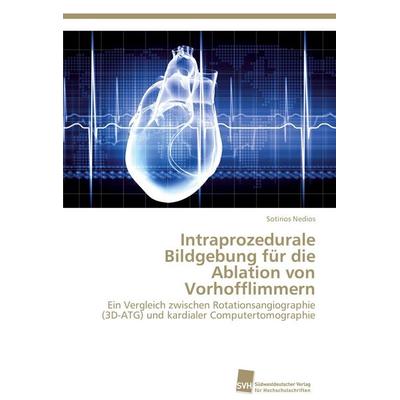 Intraprozedurale Bildgebung für die Ablation von Vorhofflimmern, Taschenbuch von Sotirios Nedios, Südwestdeutscher Verlag für Hochschulschriften,
