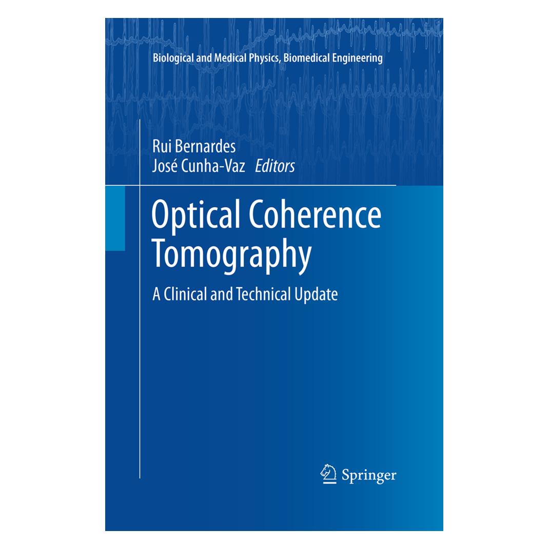 Springer Optical Coherence Tomography (Englisch, Softcover, José Cunha-Vaz, Rui Bernardes) (55946433)