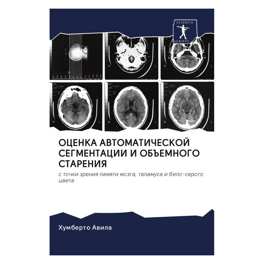 Various Publishers Ocenka Avtomaticheskoj Segmentacii I Ob#Emnogo Stareniya (56163072)
