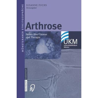 Arthrose, Taschenbuch von Susanne Fuchs, Steinkopff, 978-3-7985-1457-7