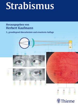 Herbert Kaufmann - Strabismus - Preis vom 10.10.2026 11:48:34 h