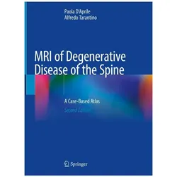 MRI of Degenerative Disease of the Spine, Fachbücher von Paola D'Aprile, Alfredo Tarantino