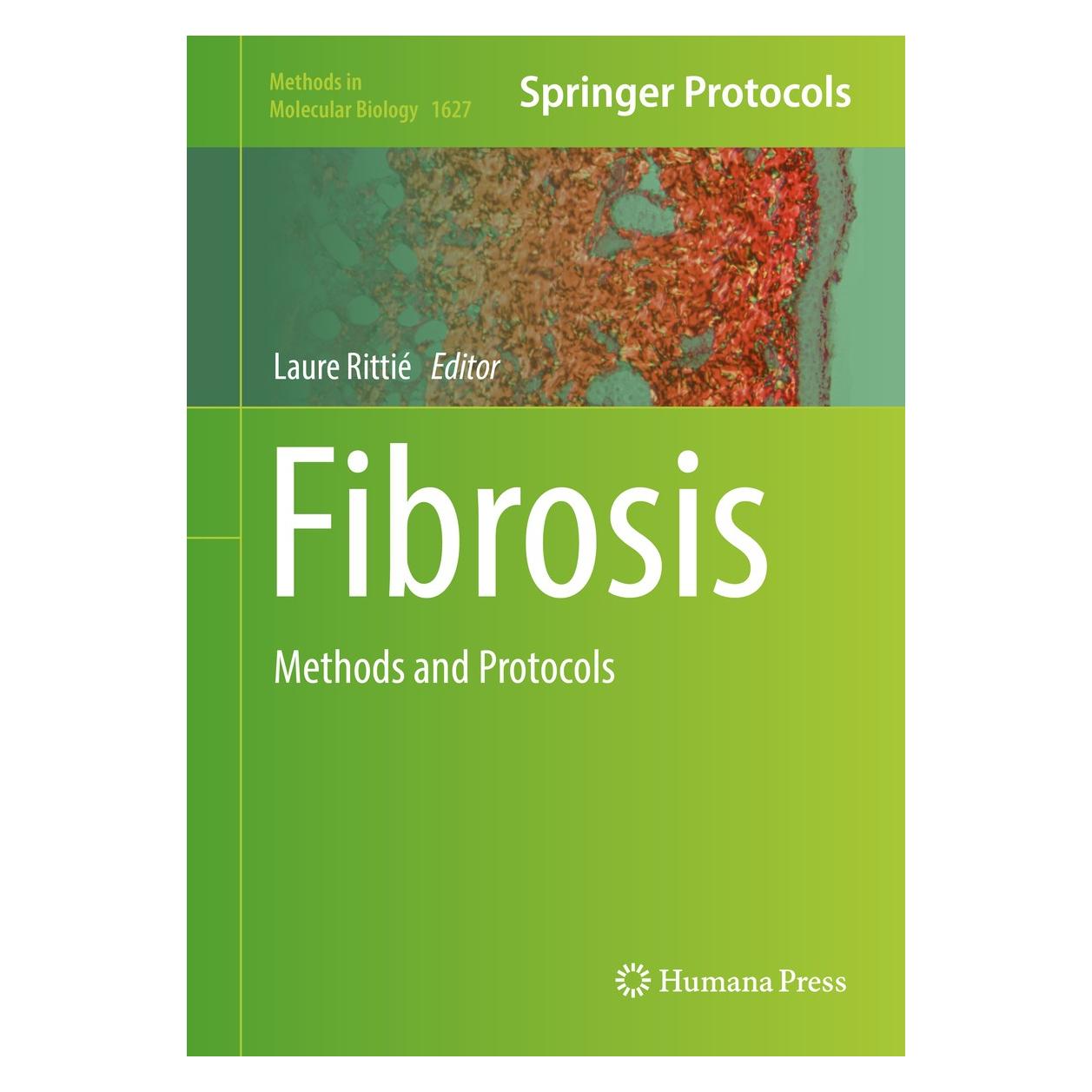 Springer Fibrosis (Englisch, Hardcover, Laure Rittié) (9781493971121)
