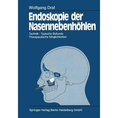 Endoskopie der Nasennebenhöhlen, Taschenbuch von Wolfgang Draf, Springer Berlin, 978-3-662-07022-2