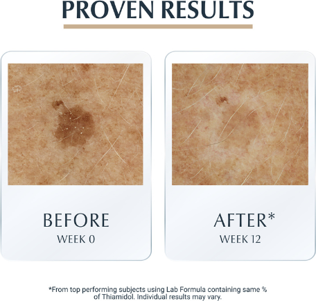 Eucerin Hyaluron-Filler + Elasticity Sérum 3D 30ml