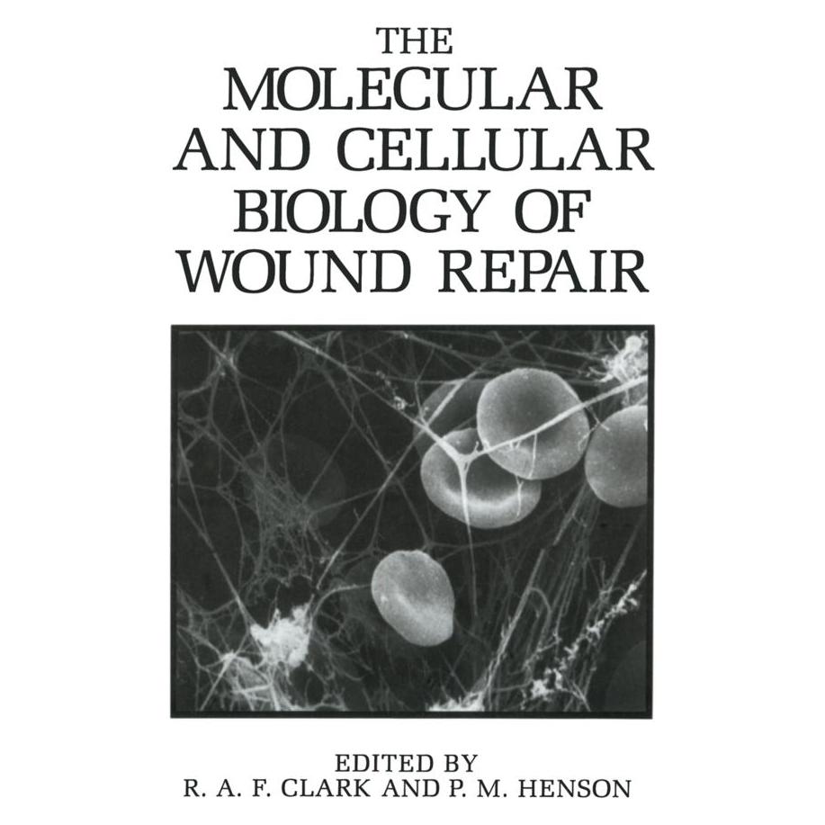 Springer The Molecular and Cellular Biology of Wound Repair (Englisch, Softcover, Peter Henson, Richard Clark) (55529910)