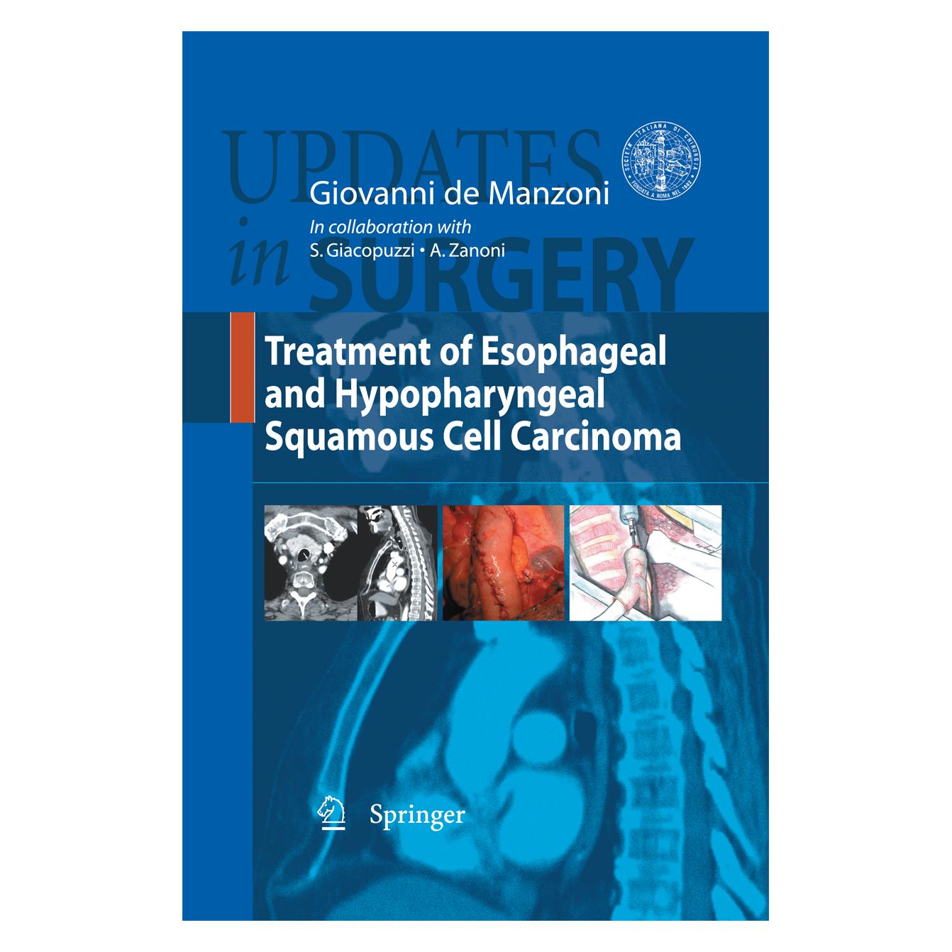 Springer Treatment of Esophageal and Hypopharyngeal Squamous Cell Carcinoma (Englisch, Softcover, Giovanni De Manzoni) (55580730)