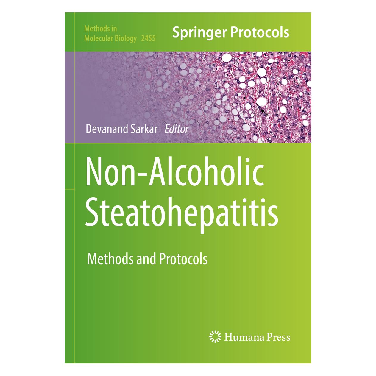 Springer Non-Alcoholic Steatohepatitis (Englisch, Softcover, Devanand Sarkar) (56935335)