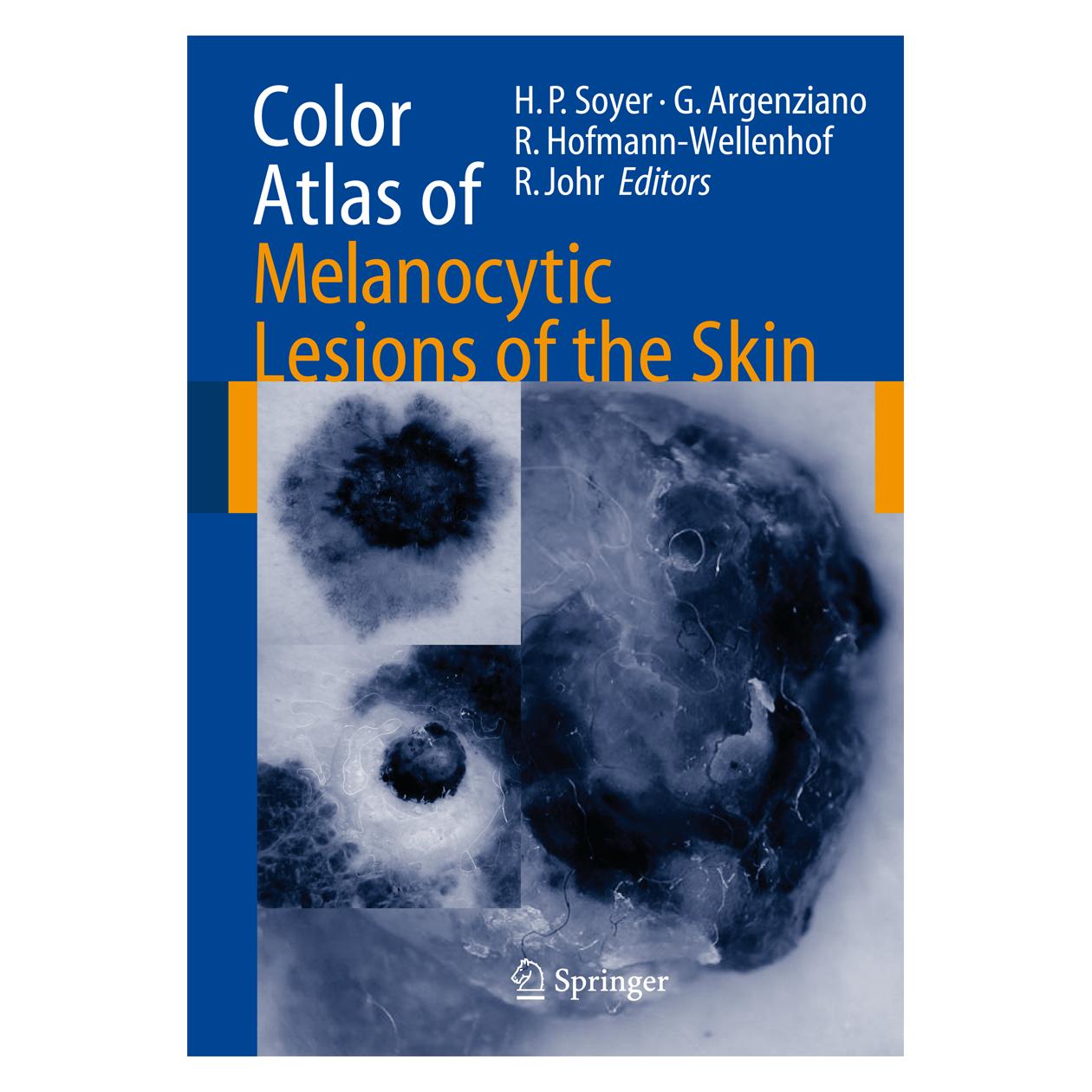 Springer Color Atlas of Melanocytic Lesions of the Skin (Englisch, Softcover, Giuseppe Argenziano, H. Peter Soyer, Rainer Hofmann-Wellenhof, Robert H. Johr) (55374023)