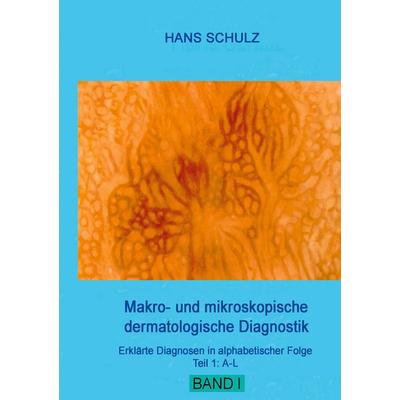 Makro- und mikroskopische dermatologische Diagnostik, Taschenbuch von Hans Schulz, BoD – Books on Demand, 978-3-7557-1929-8