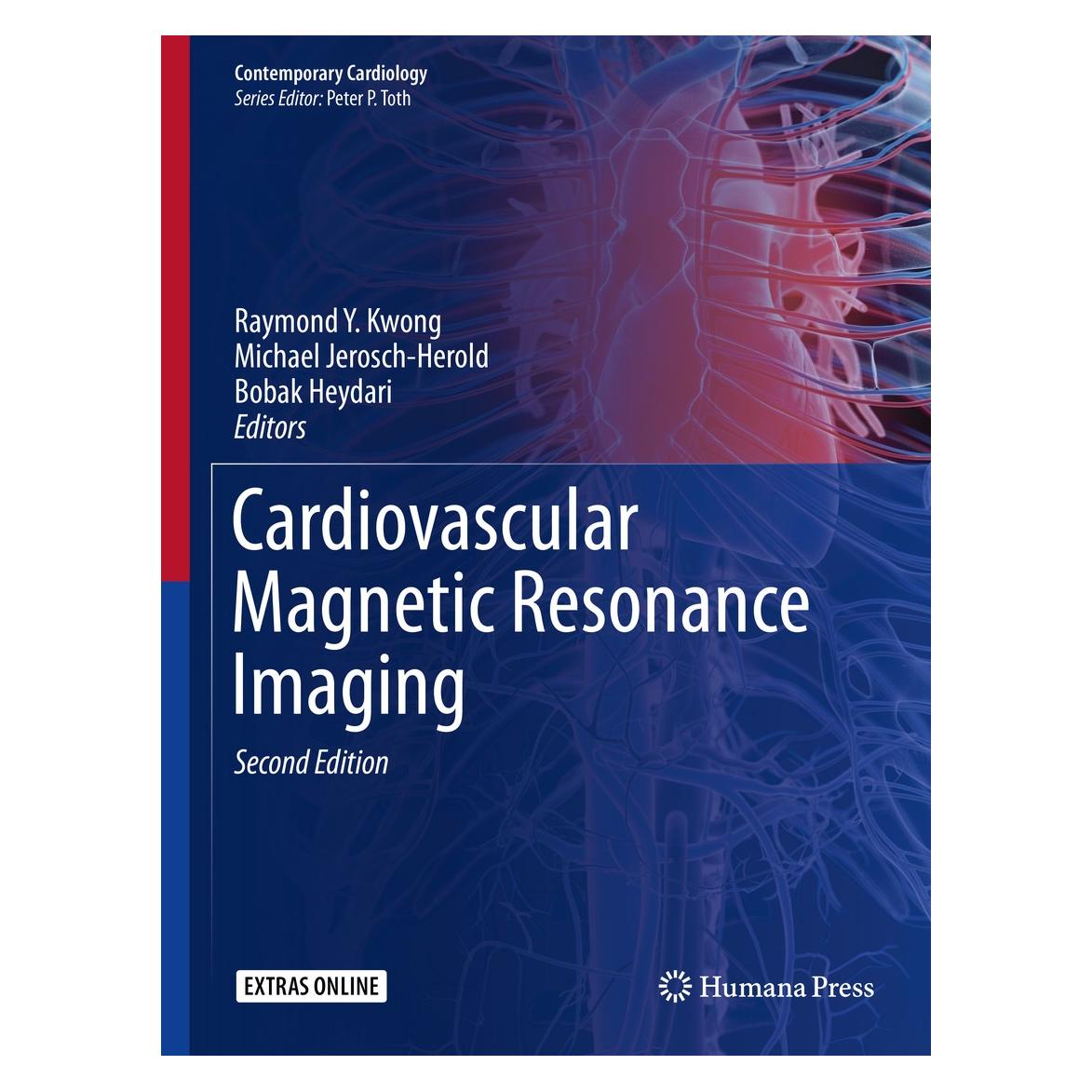 Springer Cardiovascular Magnetic Resonance Imagi (Englisch, Hardcover, Bobak Heydari, Michael Jerosch-Herold, Raymond Y. Kwong) (9781493988396)