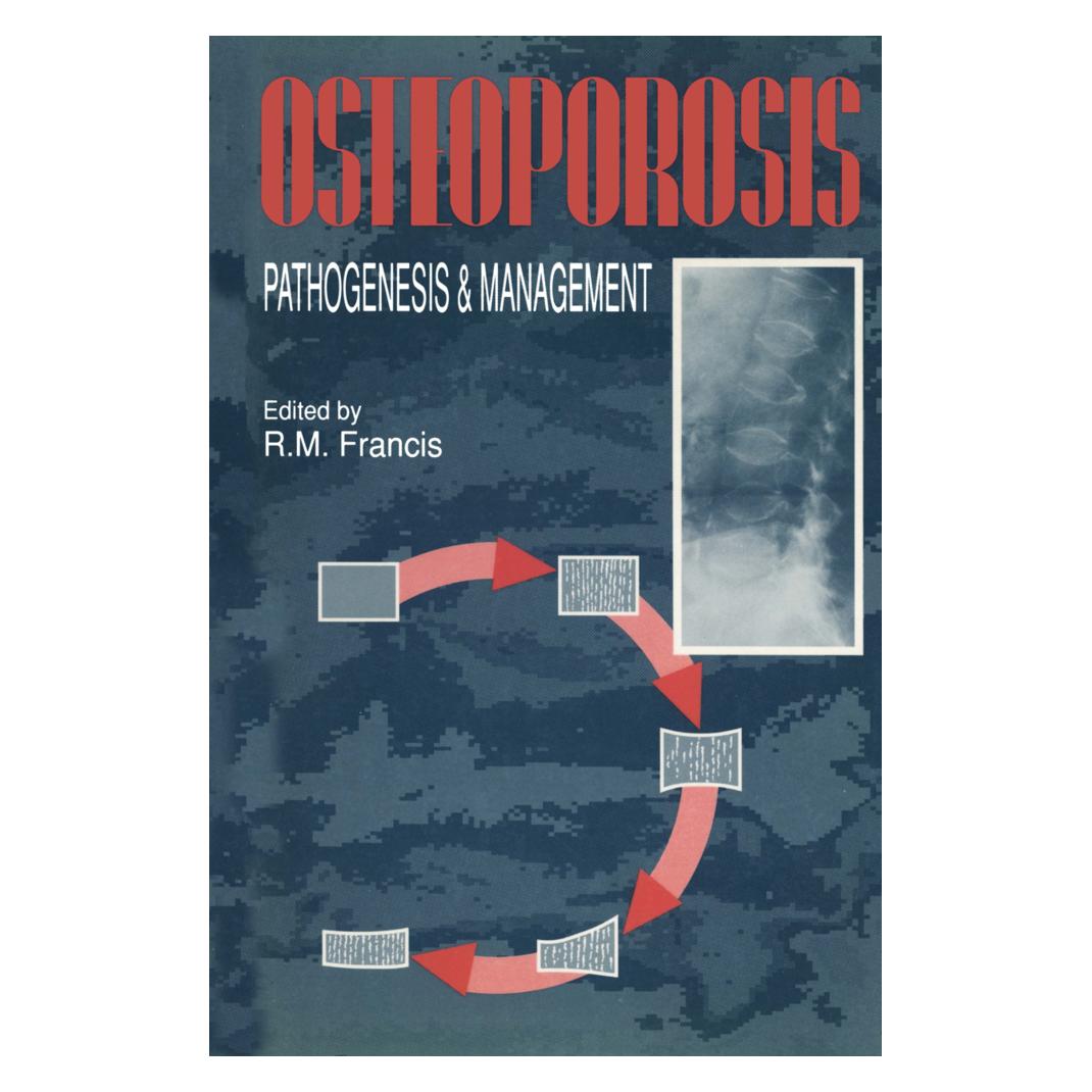 Springer Osteoporosis (Englisch, Softcover, R. M. Francis) (55533869)