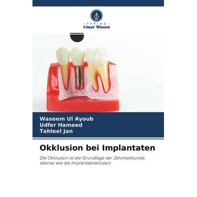 Okklusion bei Implantaten, Taschenbuch von Waseem Ul Ayoub,Udfer Hameed,Tahleel Jan, Verlag Unser Wissen, 978-620-4-64185-0