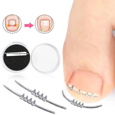 Uplift Essentials Ingrown Toenail Corrector Precision Leverage Pedicure Tool For Curvature Correction Ingrown Toenail Corrector Precision Leverage Pedicure Tool For Curvature Correction
