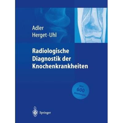 Radiologische Diagnostik der Knochenkrankheiten, Taschenbuch von Claus-Peter Adler,Georg Herget,Markus Uhl, Springer Berlin, 978-3-662-09661-1