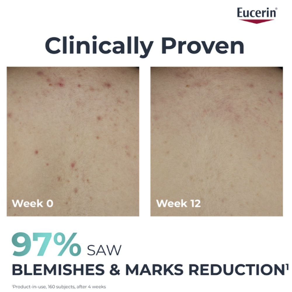 Eucerin Dermopure Clinical Correcting Body Care Cream Anti-Blemish 200mL