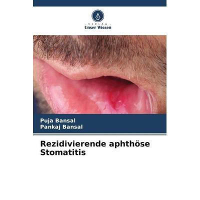 Rezidivierende aphthöse Stomatitis, Taschenbuch von Puja Bansal,Pankaj Bansal, Verlag Unser Wissen, 978-620-4-78555-4
