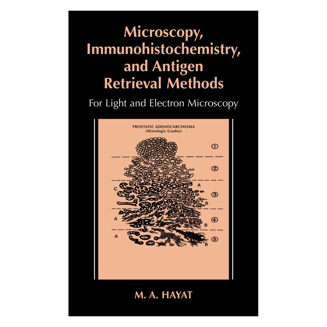 Springer Microscopy, Immunohistochemistry, and Antigen Retrieval Methods (Englisch, Softcover, M.A. Hayat) (55530249)