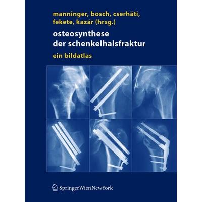 Osteosynthese der Schenkelhalsfraktur, Gebundene Ausgabe von Jenö Manninger,Ulrich Bosch,Peter Cserhati, Springer Wien