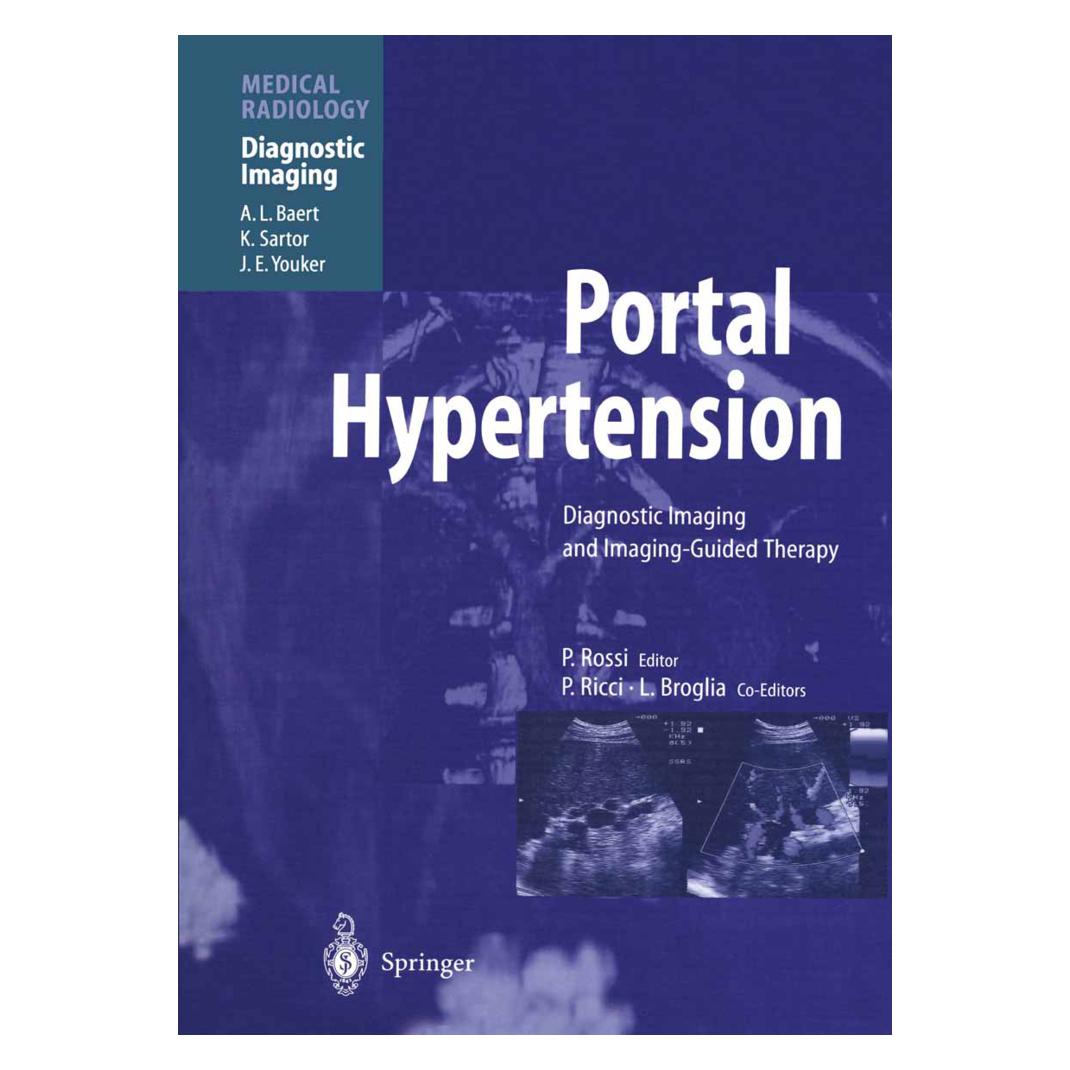 Springer Portal Hypertension (Englisch, Softcover, Plinio Rossi) (55531256)
