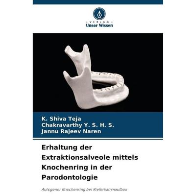Erhaltung der Extraktionsalveole mittels Knochenring in der Parodontologie, Taschenbuch von K. Shiva Teja,Chakravarthy Y. S. H. S.,Jannu Rajeev Naren,