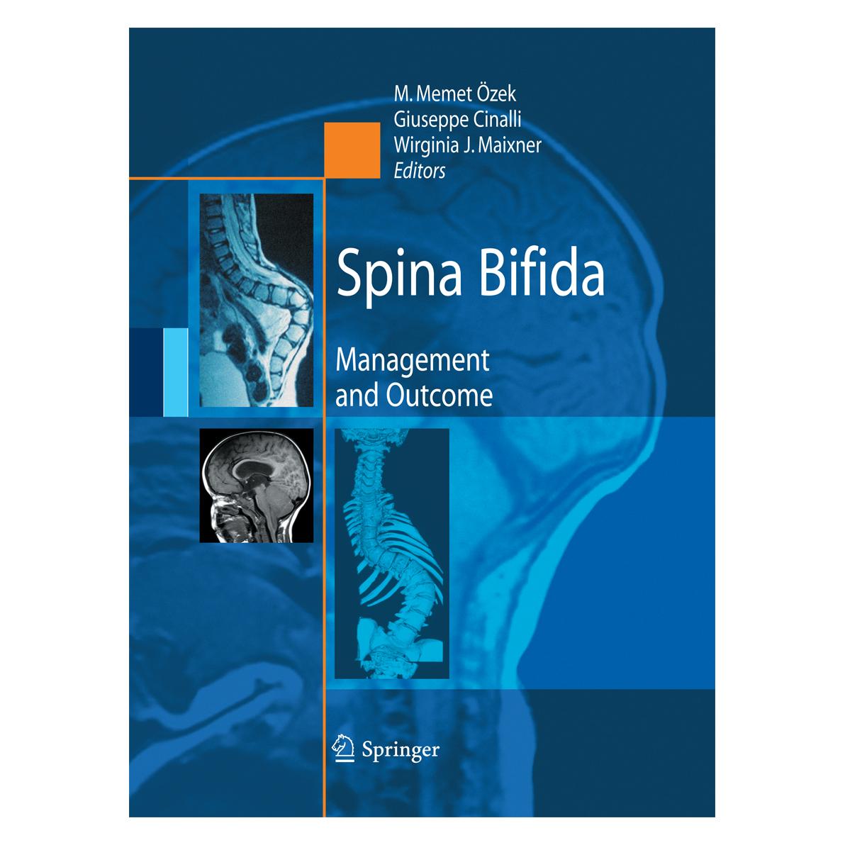 Springer Spina Bifida (Englisch, Softcover, Giuseppe Cinalli, M. Memet Özek, Wirginia Maixner) (55578438)