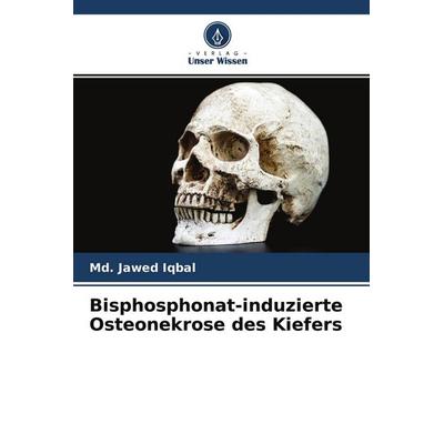 Bisphosphonat-induzierte Osteonekrose des Kiefers, Taschenbuch von Md. Jawed Iqbal, Verlag Unser Wissen, 978-620-4-46854-9