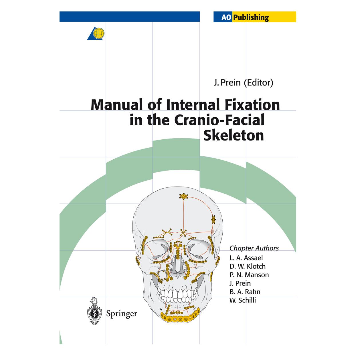 Springer Manual of Internal Fixation in the Cranio-Facial Skeleton (Englisch, Softcover, Joachim Prein) (55561027)