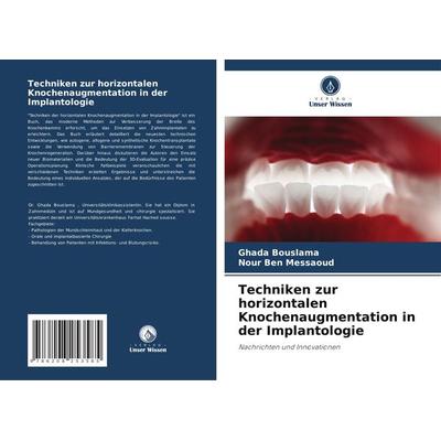 Techniken zur horizontalen Knochenaugmentation in der Implantologie, Taschenbuch von Ghada Bouslama,Nour Ben Messaoud, Verlag Unser Wissen,