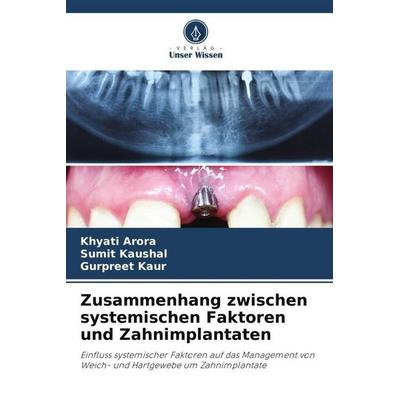 Zusammenhang zwischen systemischen Faktoren und Zahnimplantaten, Taschenbuch von Khyati Arora,Sumit Kaushal,Gurpreet Kaur, Verlag Unser Wissen,