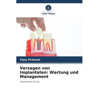 Versagen von Implantaten: Wartung und Management, Taschenbuch von Vijoy Prakash, Verlag Unser Wissen, 978-620-5-66228-1