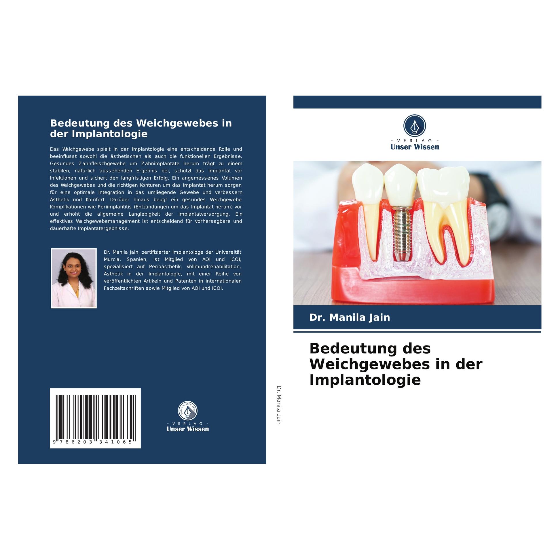 Bod Jain:Bedeutung des Weichgewebes in der (Deutsch, Softcover, Dr Manila Jain) (57195691)