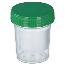 Urinbecher Mit Schraubdeck