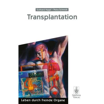 Transplantation, Taschenbuch von Eckhard Nagel,Petra Schmidt, Springer Berlin, 978-3-540-60525-6
