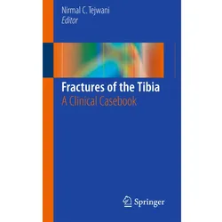 Fractures of the Tibia, Fachbücher