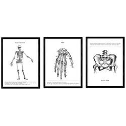 POSTER Set Mit 3 Skelett, Hand, Becken A4 Rahmenlos