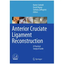 Anterior Cruciate Ligament Reconstruction, Fachbücher von Stefano Zaffagnini, Rainer Siebold, David Dejour