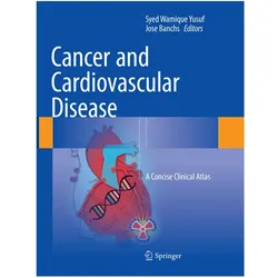 Cancer and Cardiovascular Disease, Fachbücher