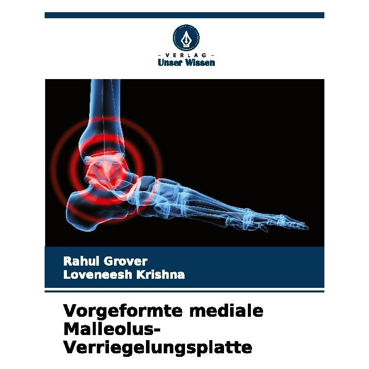 Bod Vorgeformte mediale Malleolus-Verriegelungsplatte (Deutsch, Softcover, Loveneesh Krishna, Rahul Grover) (57190441)