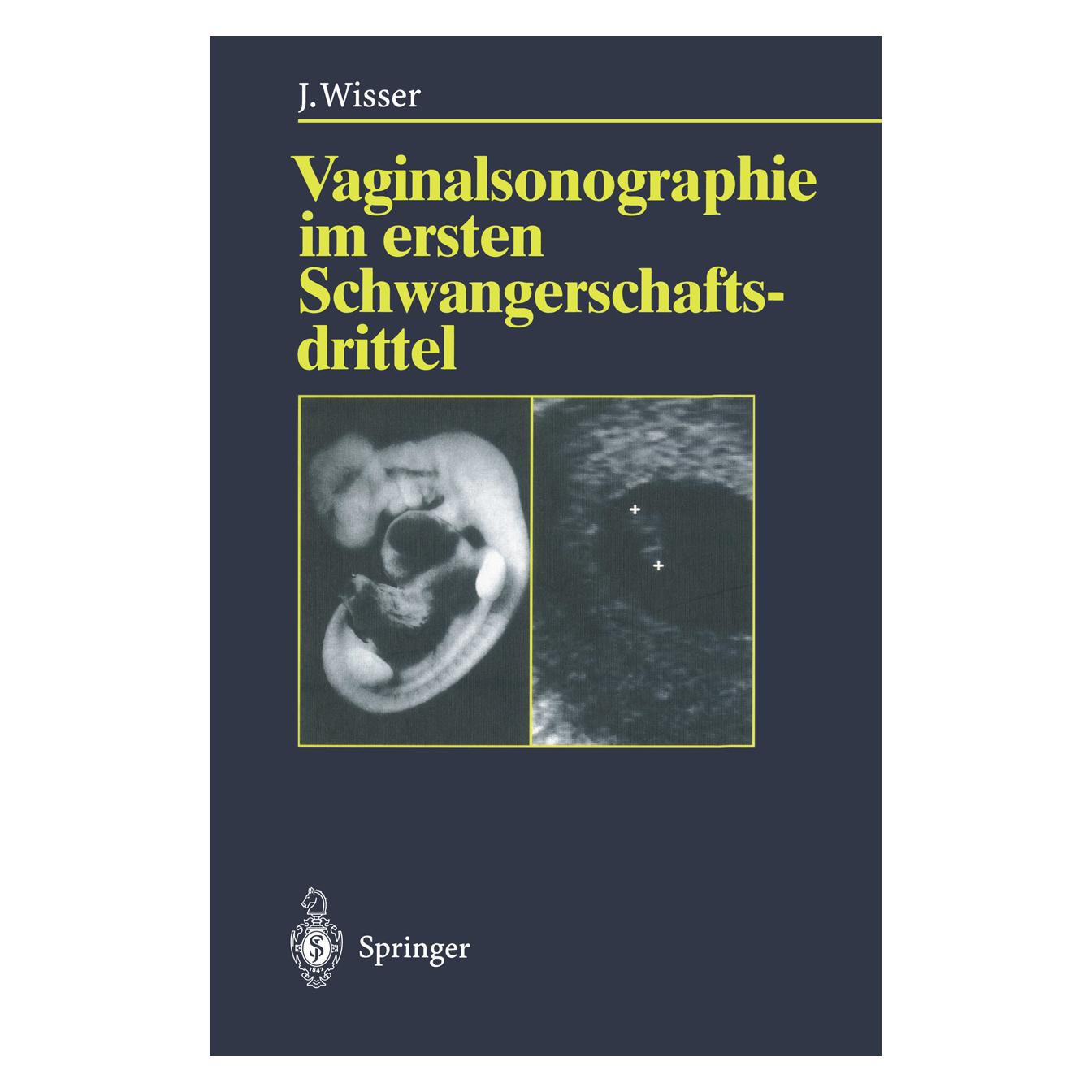 Springer Vaginalsonographie im ersten Schwangerschaftsdrittel (Deutsch, Softcover, Josef Wisser) (55508287)