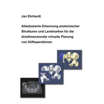 Atlasbasierte Erkennung anatomischer Strukturen und Landmarken für die dreidimensionale virtuelle Planung von Hüftoperationen, Taschenbuch von Jan