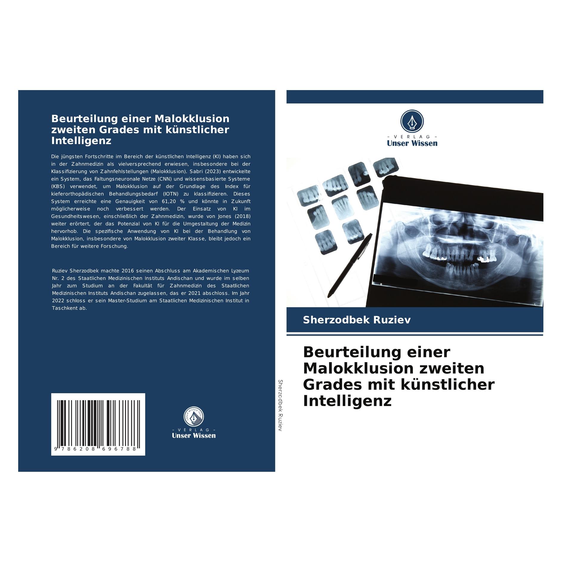 Bod Beurteilung einer Malokklusion zweiten Grades mit künstlicher Intelligenz (Deutsch, Softcover, Sherzodbek Ruziev) (57211433)