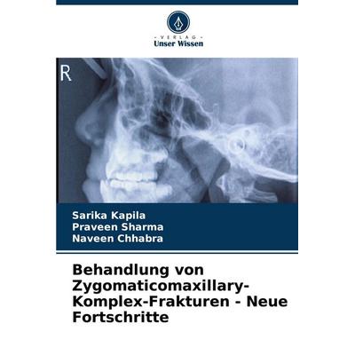 Behandlung von Zygomaticomaxillary-Komplex-Frakturen - Neue Fortschritte, Taschenbuch von Sarika Kapila,Praveen Sharma,Naveen Chhabra, Verlag Unser