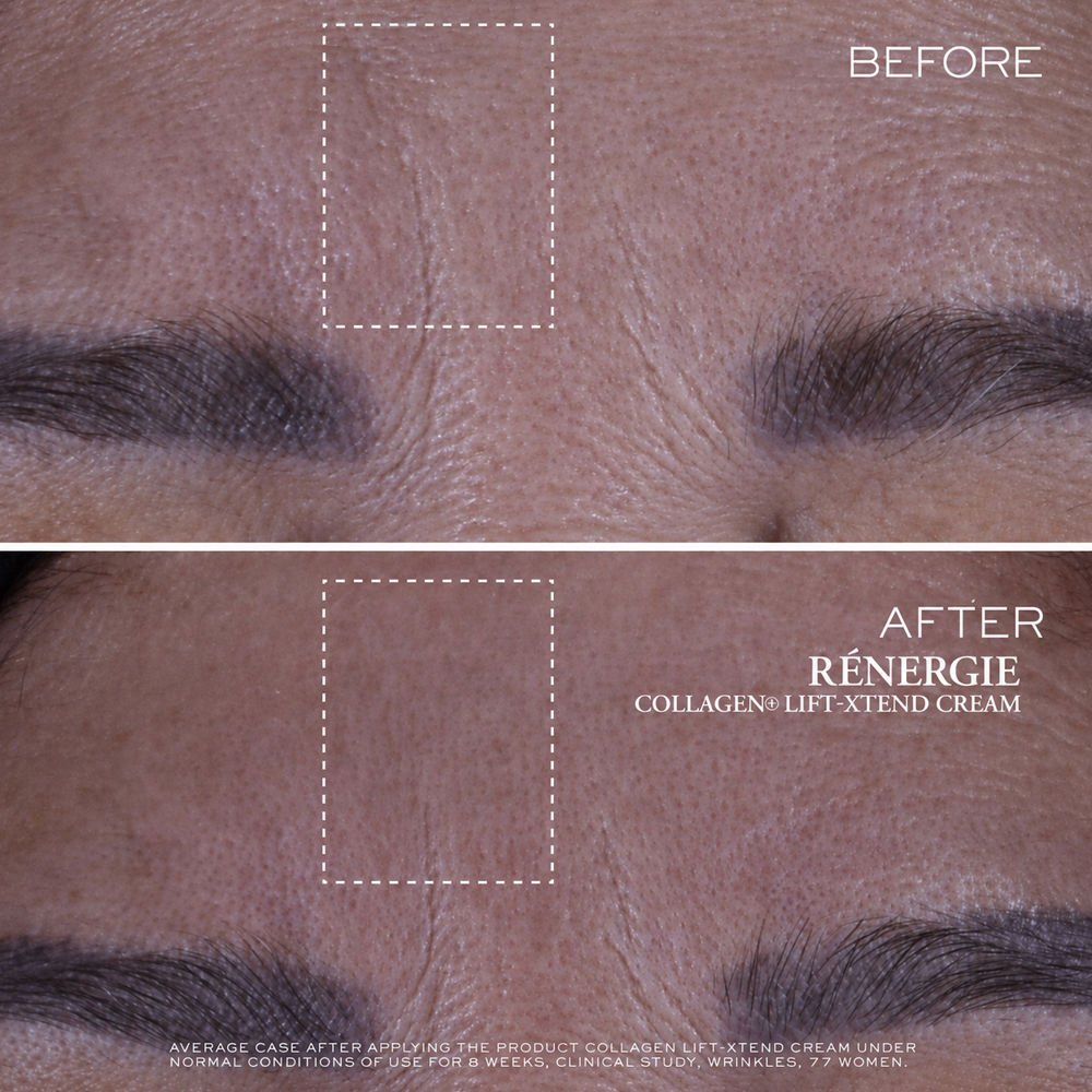 Lancôme Rénergie COLLAGEN+ LIFT-XTEND crema 30 ml
