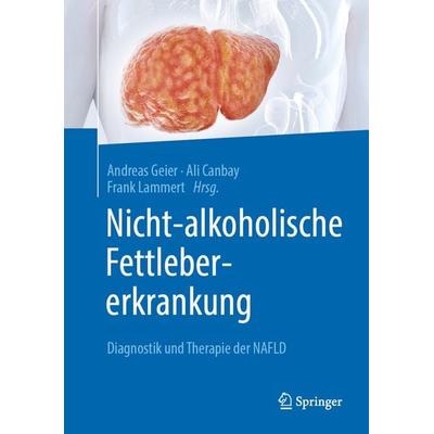 Nicht-alkoholische Fettlebererkrankung, Gebundene Ausgabe von , Springer Berlin, 978-3-662-62483-8